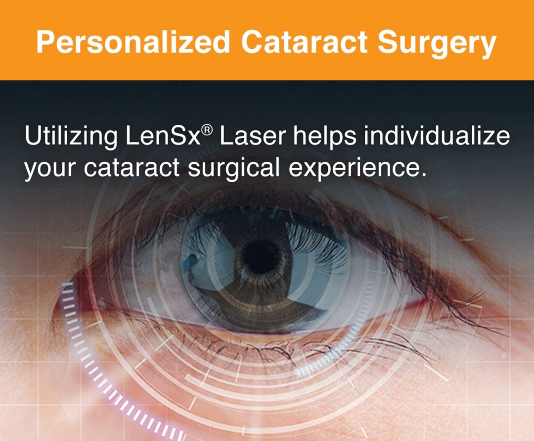 Personalized Laser Cataract Surgery Fraser Eye Care Center