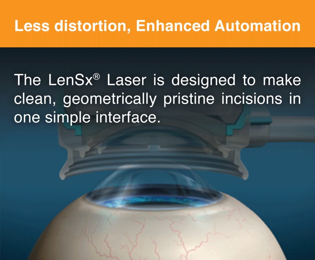 Safety Laser Cataract Surgery Fraser Eye Care Center