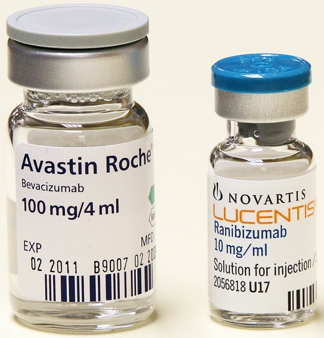 Eye Injections For Diabetes 27 How to Plan a Wedding Step by Step