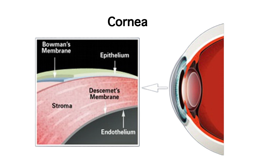 Fuchs Dystrophy eye diagram