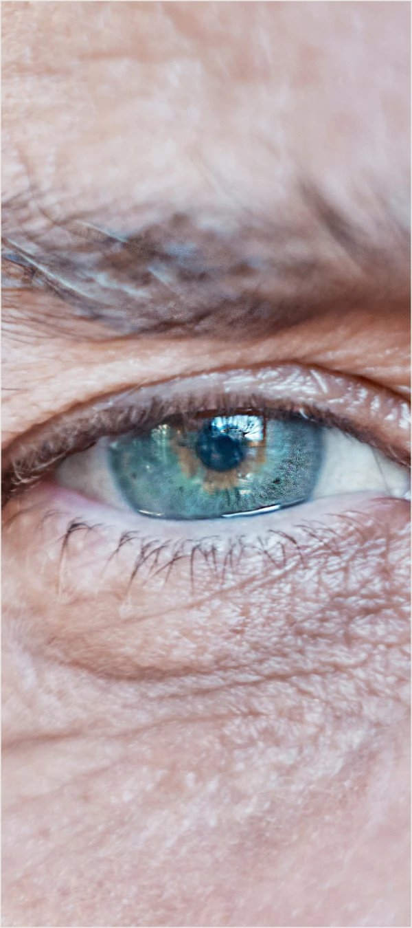 blue eye of a senior upclose